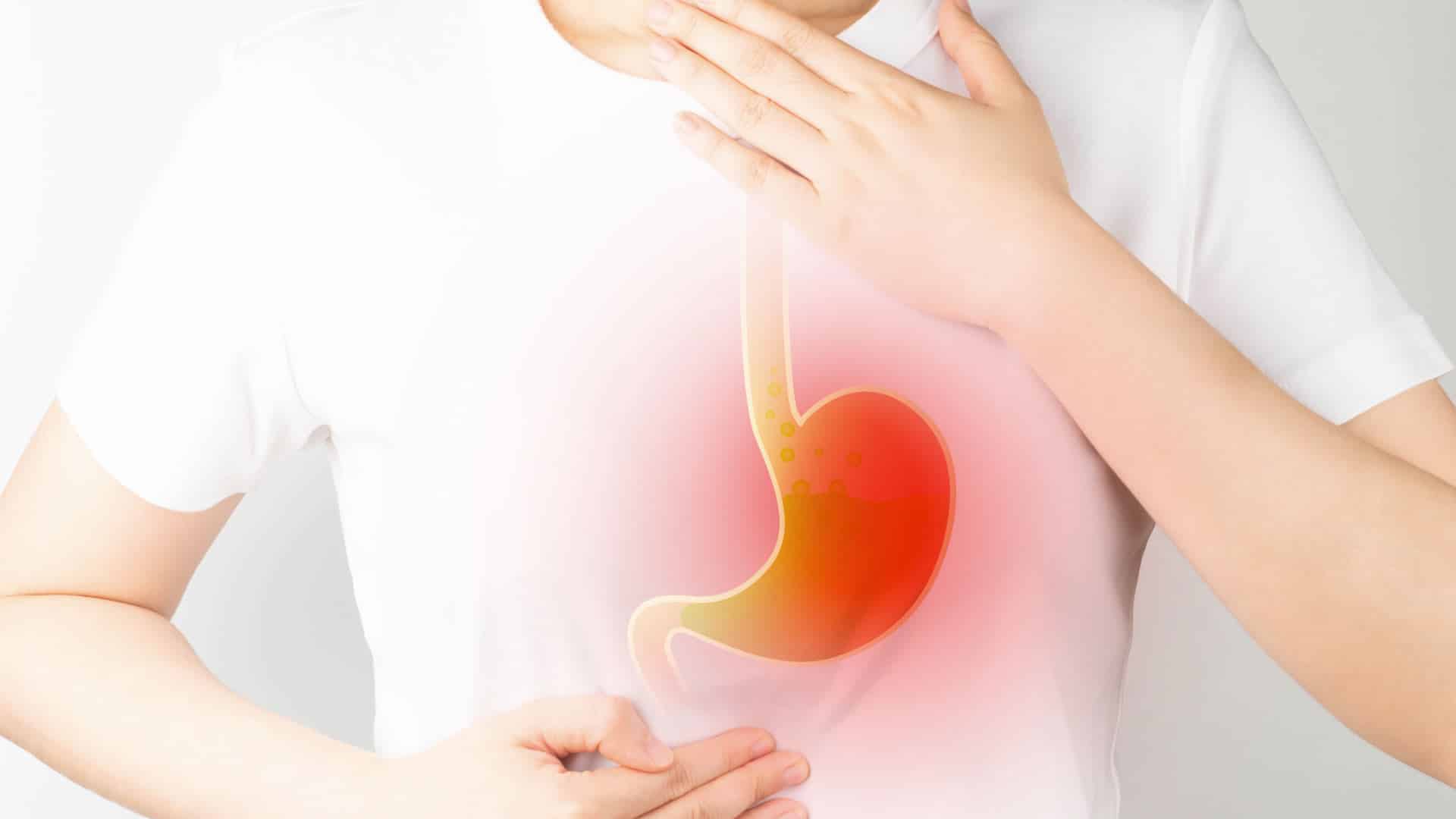 Quais as diferenças entre refluxo gastroesofágico e gastrite?