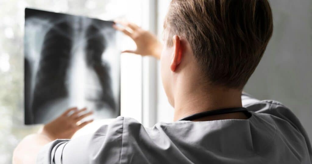 investigação da tosse crônica