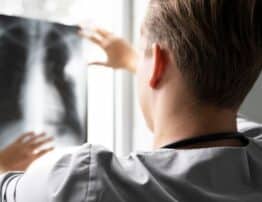 investigação da tosse crônica