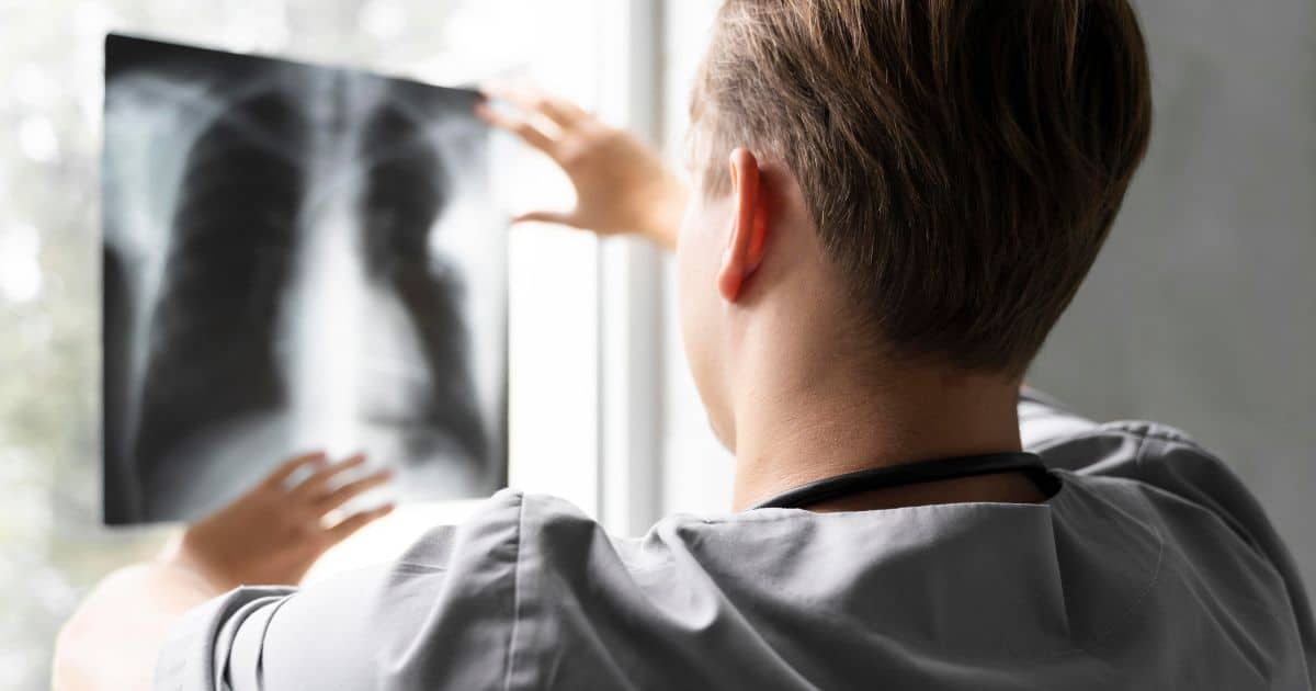 investigação da tosse crônica